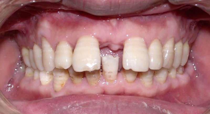 Orthodontie et parodontie